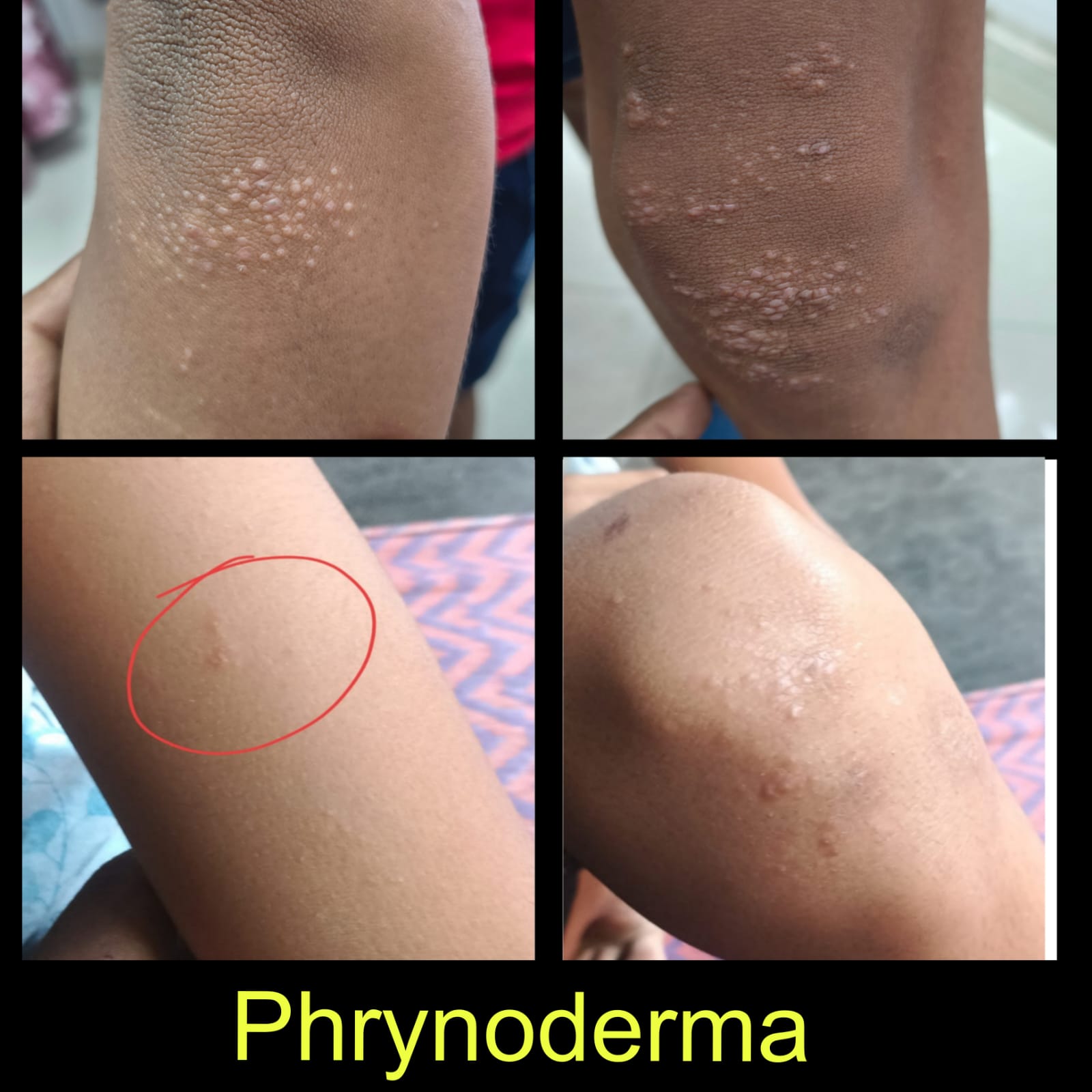 Treatment Image 10