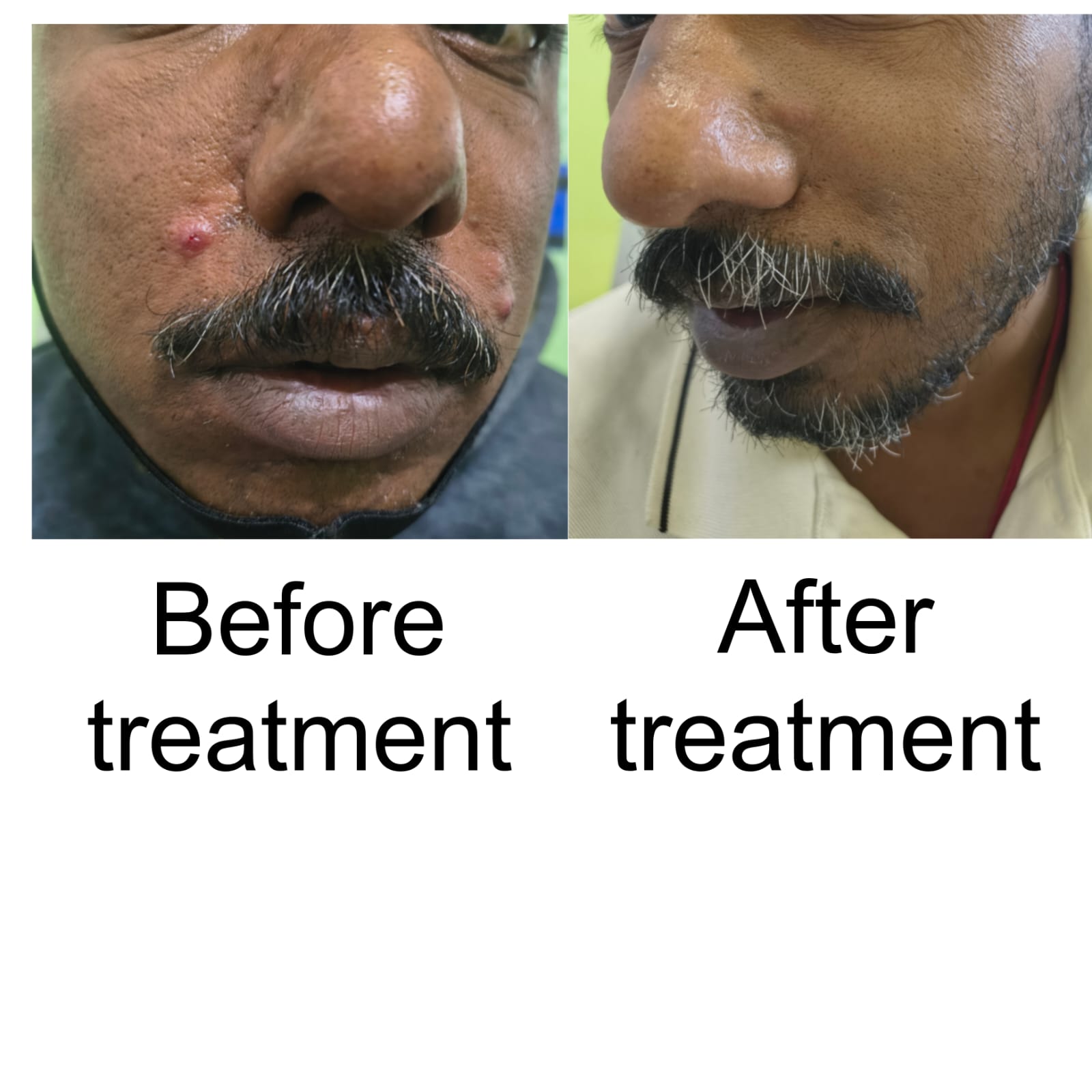 Treatment Image 12