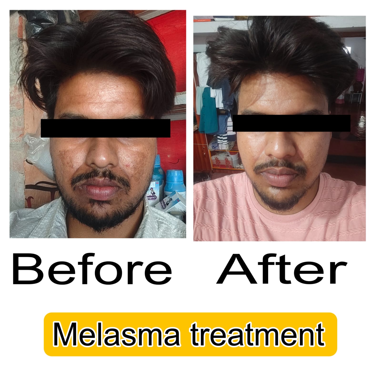 Treatment Image 17