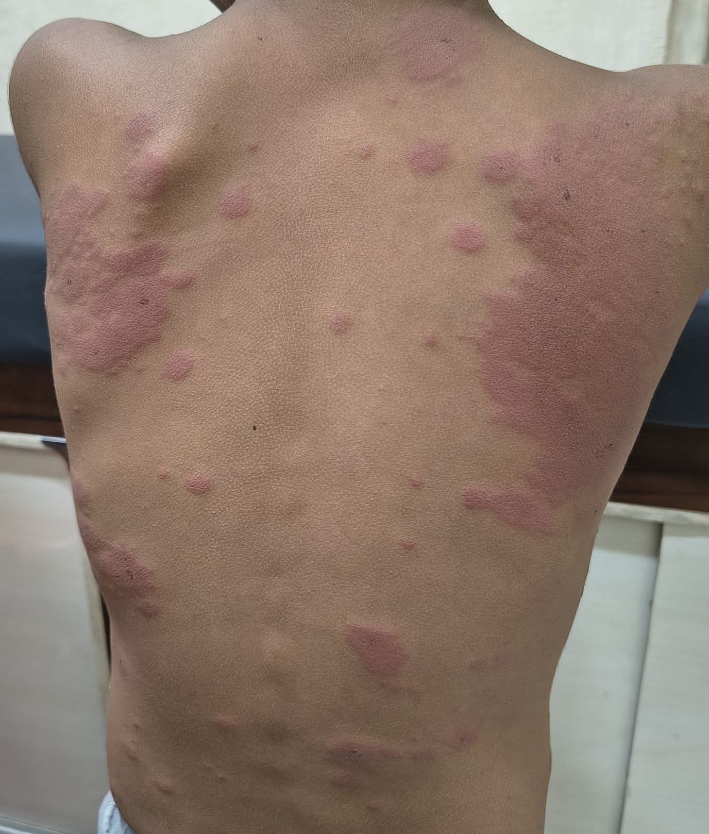 Treatment Image 2