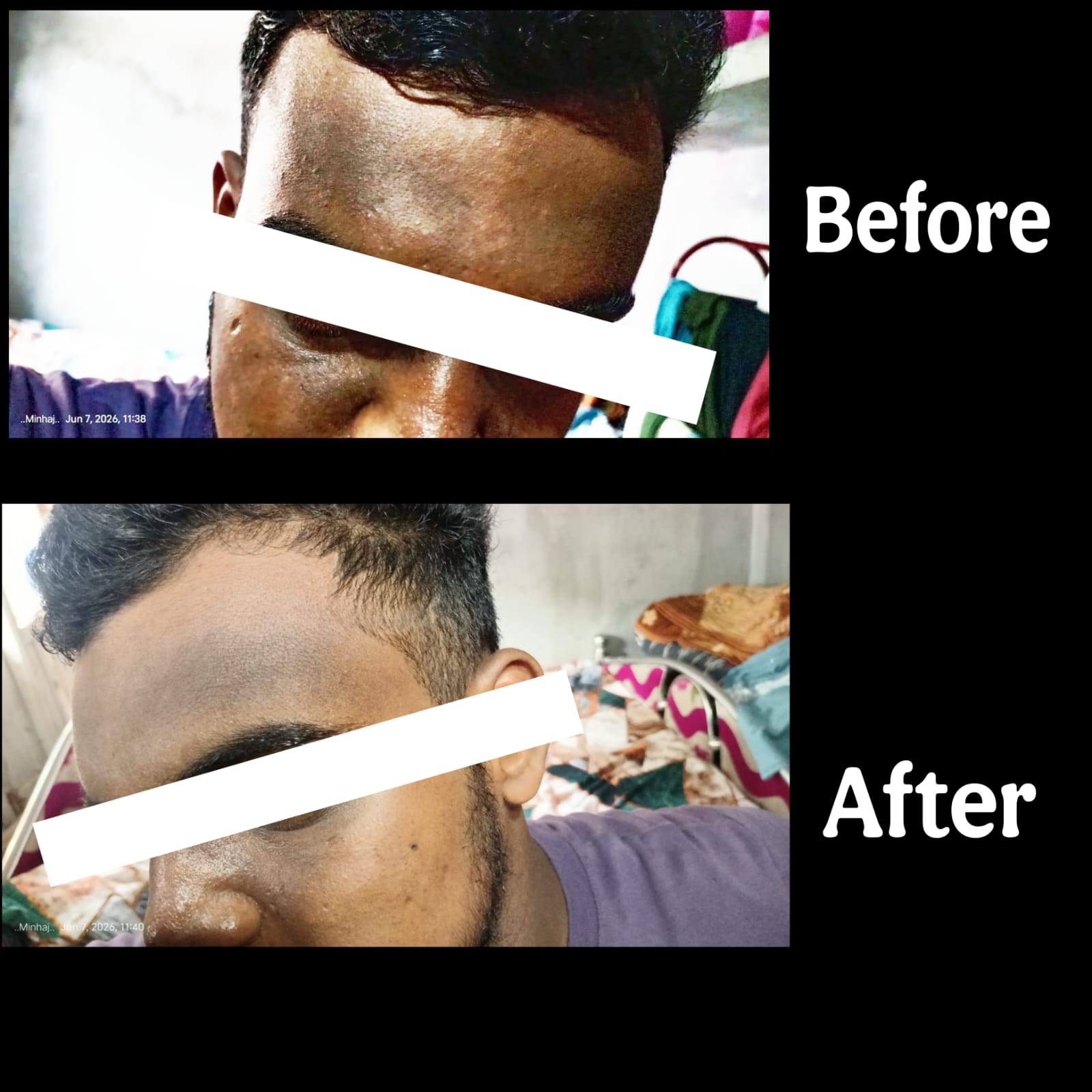 Best melasma treatment berhampore.
                                                                           Best mecheta treatment berhampore.
                                                                           Best mecheta doctor berhampore.
                                                                           Black spots treatment berhampore.