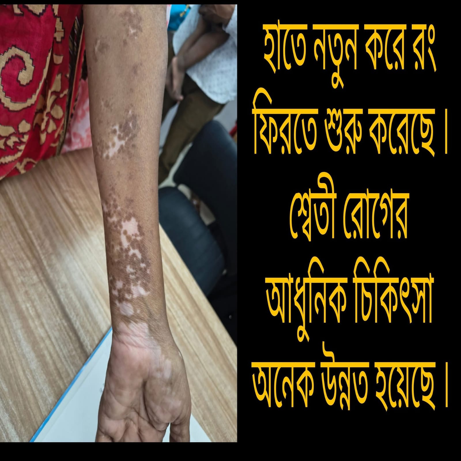 Treatment Image 4